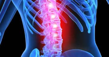 Spinal Instability