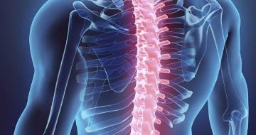Spinal Stenosis